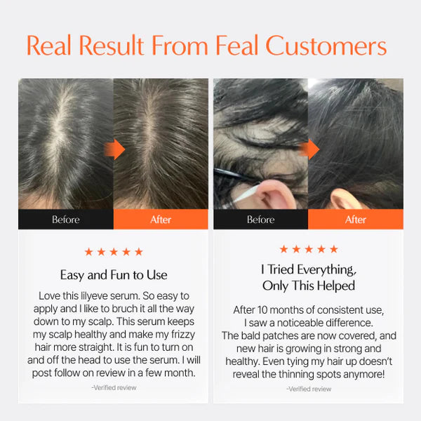 Korean Growturn Ampoule Hair Serum with Built in Brush