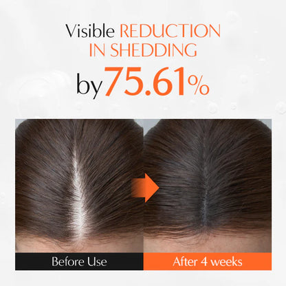 Korean Growturn Ampoule Hair Serum with Built in Brush