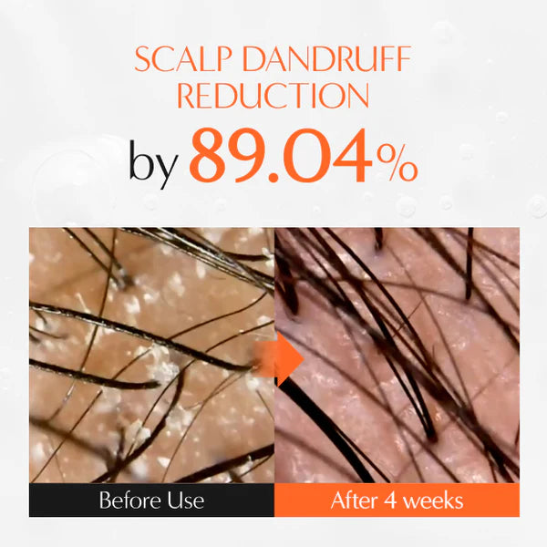 Korean Growturn Ampoule Hair Serum with Built in Brush